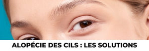 Alopécie Extension de Cils
